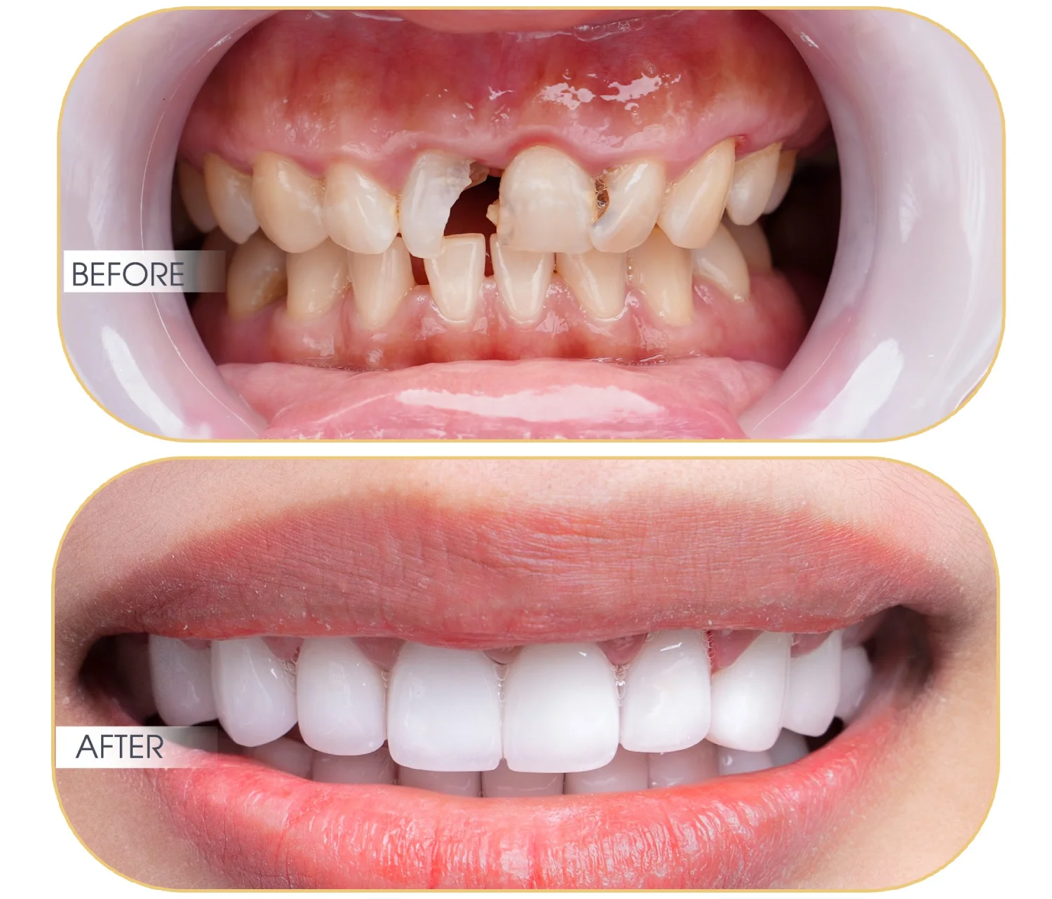 lam-rang-su-huong-dan-chi-tiet-tu-a-den-z-66c25d455f1cf