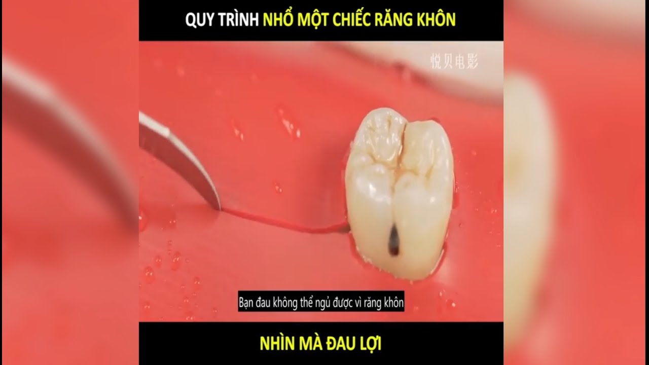 Phòng khám răng gần đây - Dịch vụ chăm sóc cao cấp