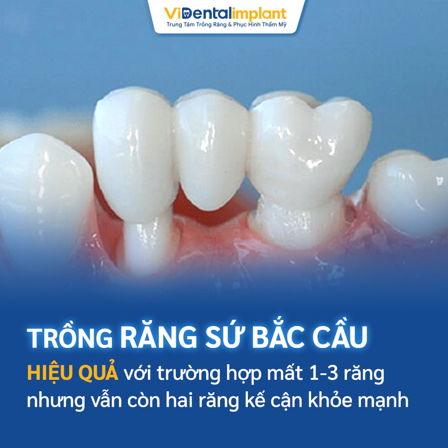 Phòng khám răng gần nhất: Dịch vụ uy tín, ưu việt Phòng khám răng gần nhất: Dịch vụ uy tín, ưu việt