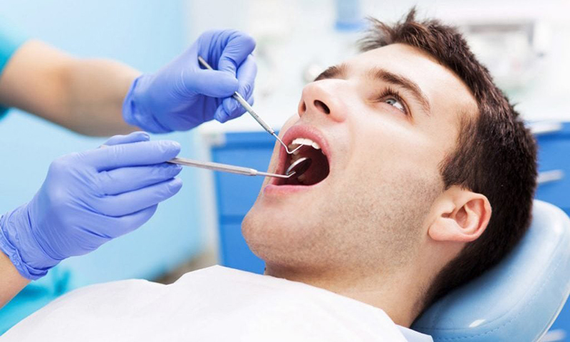 Răng Khôn Những Điều Cần Biết