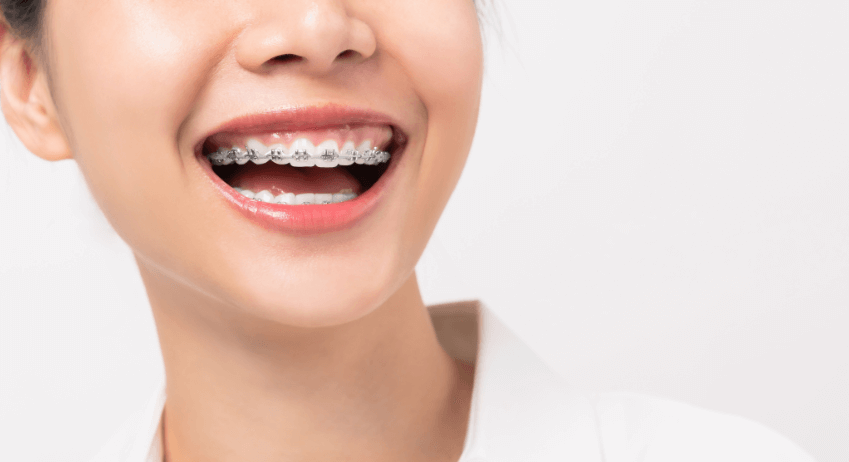 Nha khoa niềng răng gần đây - Dịch vụ chất lượng, giá tốt