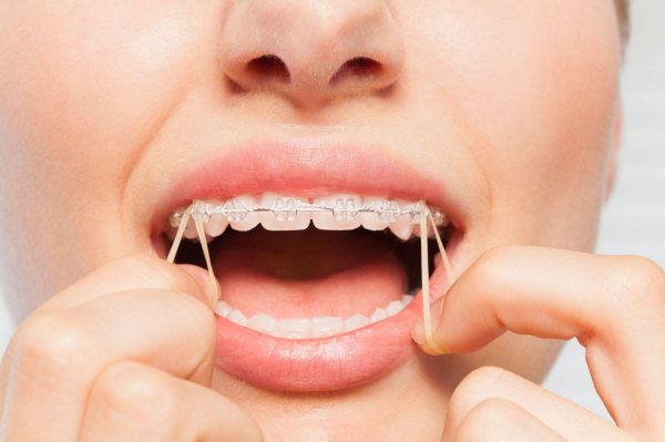 Chỉnh Nha Gần Đây - Những Xu Hướng Mới Và Phương Pháp Tiến Bộ