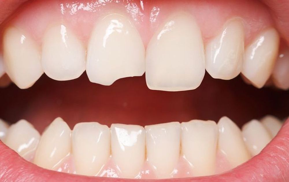Dịch vụ hàn răng gần đây - Giải pháp chăm sóc sức khỏe răng miệng hiệu quả