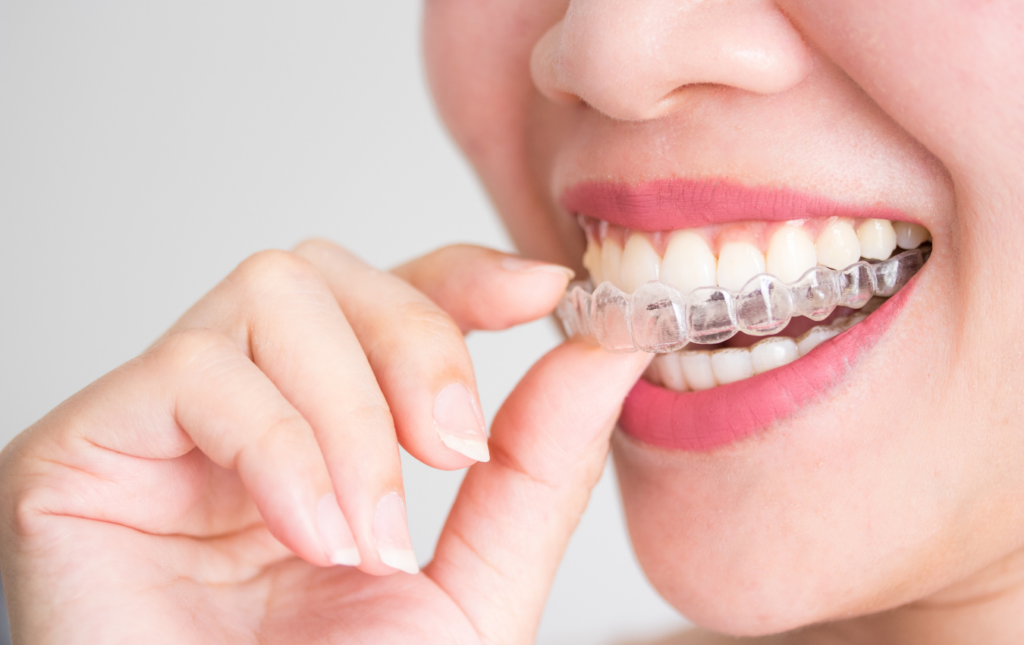Dịch vụ hàn răng gần đây - Giải pháp chăm sóc sức khỏe răng miệng hiệu quả