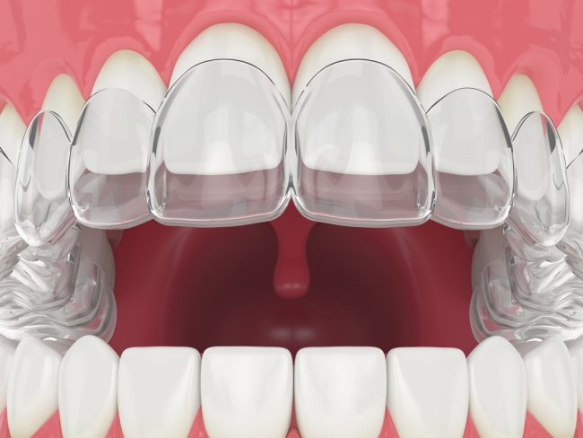 dịch vụ lấy cao răng điều trị nha chu gần đây