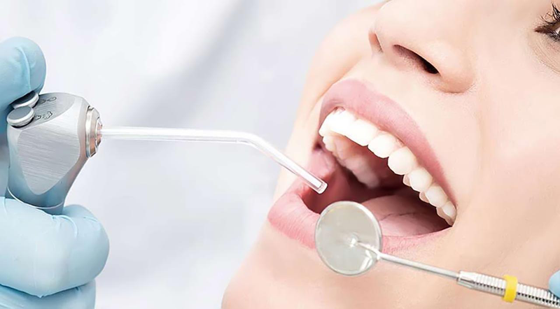 Các phương pháp hàn răng hiện nay