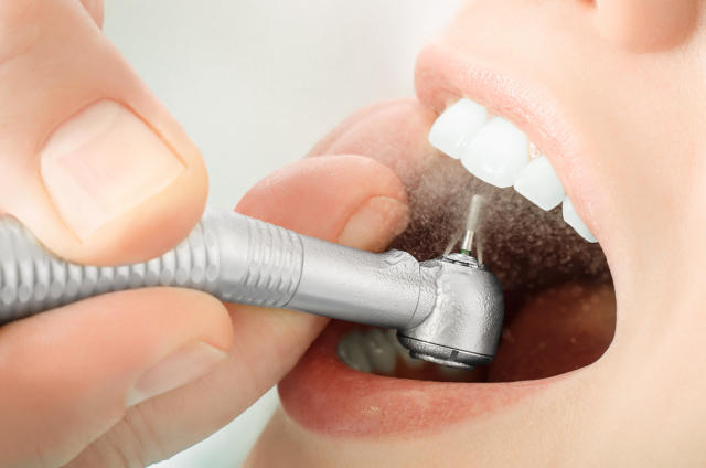 Hàn Răng Sâu Gần Đây - Bảo Vệ Nụ Cười Của Bạn