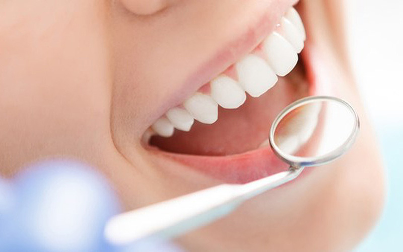 Khám Răng Hàm Mặt - Hướng Dẫn, Lợi Ích và Những Điều Cần Biết