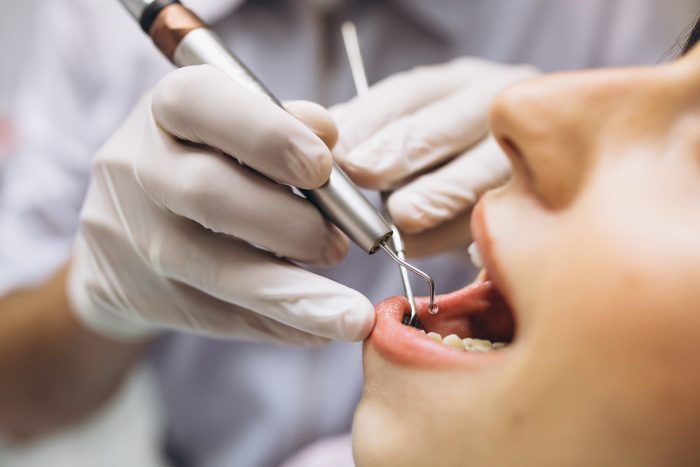 Nha Khoa Trồng Răng Sài Gòn Gần Đây - Giải Pháp Hoàn Hảo Cho Nụ Cười Tươi Tắn