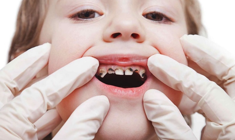 Phòng Khám Răng Gần Đây - Dịch Vụ Chăm Sóc Răng Miệng Chất Lượng Tại Địa Phương