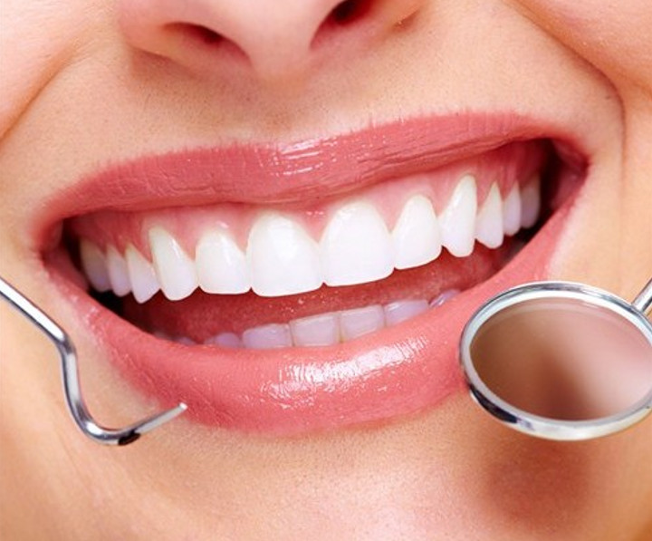 Trám răng thẩm mỹ gần đây: Xu hướng và lợi ích cho nụ cười của bạn